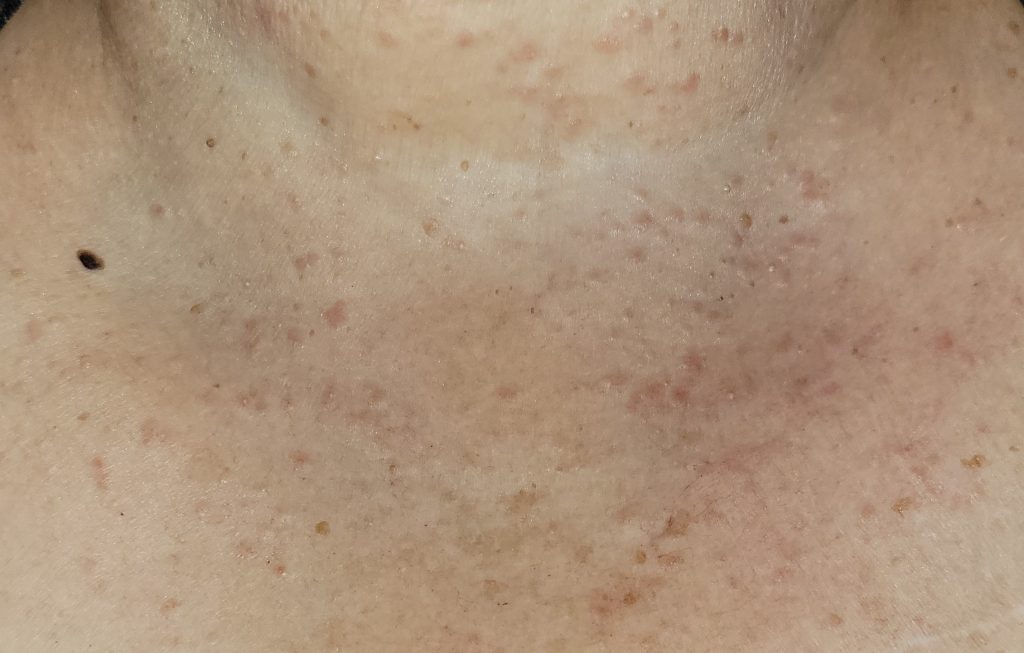 27